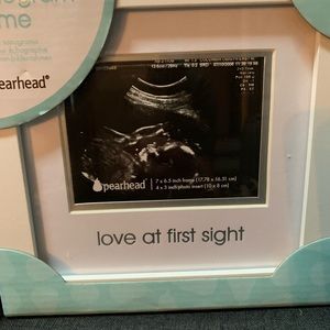 Baby’s first sonogram picture frame